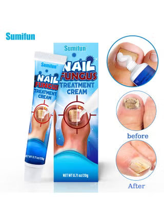 Nail Fungus Treatment Cream | كريم علاج فطريات الأظافر - Fast Repair &amp; Healthy Nail Care